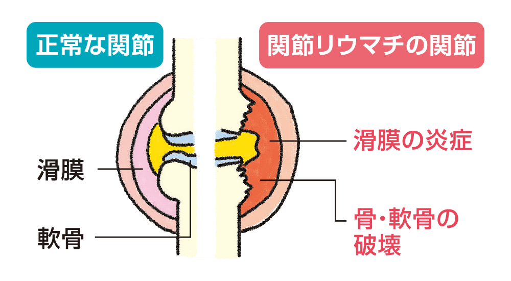親密なパートナーとの会話